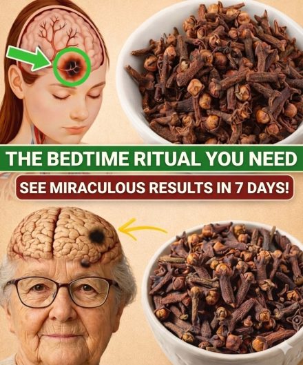 😮 What Really Happens When You Eat 2 Cloves a Day for 7 Days — The Results Surprise Many Cloves have been used for generations to support digestion, oral health, circulation, and overall balance. When consumed correctly and in the right amount, many people notice subtle but meaningful changes in how their body feels. 🌿  👇 I explain the real effects, how to take cloves safely, and who should avoid them in the first comment. Don’t miss it!